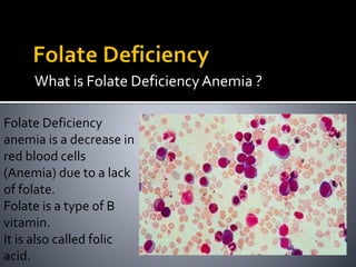 What is Folate DeficiencyAnemia ?
Folate Deficiency
anemia is a decrease in
red blood cells
(Anemia) due to a lack
of folate.
Folate is a type of B
vitamin.
It is also called folic
acid.
 