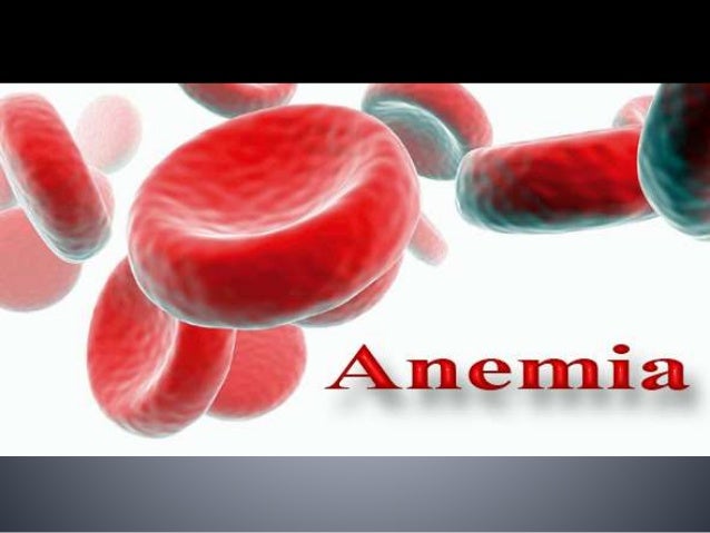 Anemia