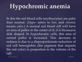 In this the red blood cells (erythrocytes) are paler
than normal. (Hypo- refers to less, and chromic
means color.) A normal red blood cell will have
an area of pallor in the center of it; it is biconcave
disk shaped. In hypochromic cells, this area of
central pallor is increased. This decrease in
redness is due to a disproportionate reduction of
red cell hemoglobin (the pigment that imparts
the red color) in proportion to the volume of the
cell.
Hypochromic anemia
 