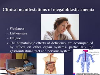  Weakness
 Listlessness
 Fatigue
 The hematologic effects of deficiency are accompanied
by effects on other organ systems, particularly the
gastrointestinal tract and nervous system.
Clinical manifestations of megaloblastic anemia
 