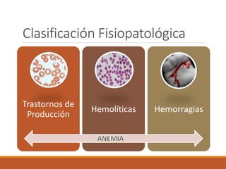 Clasificación Fisiopatológica
Trastornos de
Producción
Hemolíticas Hemorragias
 