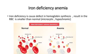 Anemia Slide 40