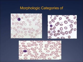 Morphologic Categories of
1 2
3
 
