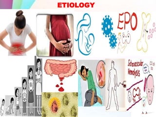ETIOLOGY
 