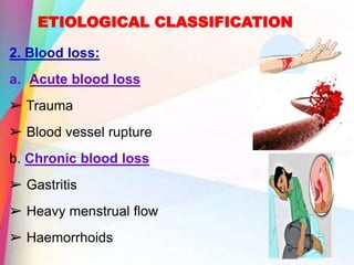 ETIOLOGICAL CLASSIFICATION
2. Blood loss:
a. Acute blood loss
➢ Trauma
➢ Blood vessel rupture
b. Chronic blood loss
➢ Gastritis
➢ Heavy menstrual flow
➢ Haemorrhoids
 