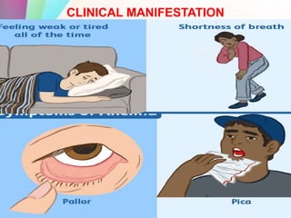 CLINICAL MANIFESTATION
 