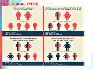ETIOLOGICAL TYPES
 