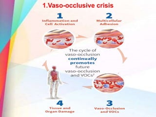 1.Vaso-occlusive crisis
 