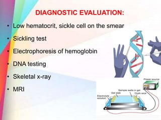 DIAGNOSTIC EVALUATION:
• Low hematocrit, sickle cell on the smear
• Sickling test
• Electrophoresis of hemoglobin
• DNA testing
• Skeletal x-ray
• MRI
 