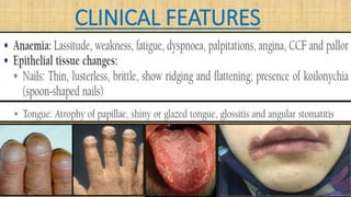 CLINICAL FEATURES