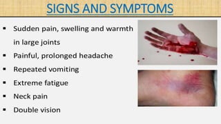 SIGNS AND SYMPTOMS