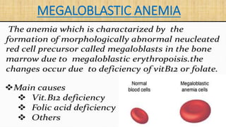 MEGALOBLASTIC ANEMIA
