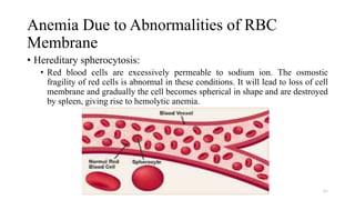 Anemia Due to Abnormalities of RBC
Membrane
• Hereditary spherocytosis:
• Red blood cells are excessively permeable to sodium ion. The osmostic
fragility of red cells is abnormal in these conditions. It will lead to loss of cell
membrane and gradually the cell becomes spherical in shape and are destroyed
by spleen, giving rise to hemolytic anemia.
61
 