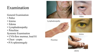 Examination
General Examination
• Pallor
• Icterus
• Edema
• Lymphadenopathy
• Petechiae
Systemic Examination
• CVS-flow murmur, loud S1
• Chest –crepts
• P/A-splenomegaly
8
Pallor
Lymphadenopathy
Icterus
Petechiae
edema
 