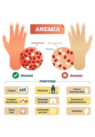 Anemia in Microbiology