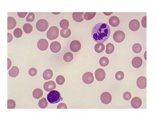 Anemia.pptx