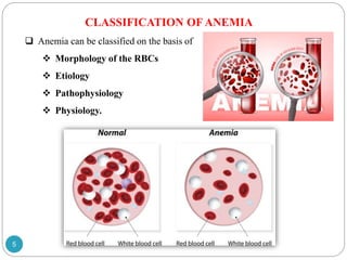 Anemia.pptx