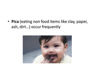• Pica (eating non food items like clay, paper,
ash, dirt…) occur frequently
 