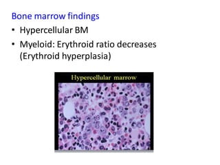 Bone marrow findings
• Hypercellular BM
• Myeloid: Erythroid ratio decreases
(Erythroid hyperplasia)
 