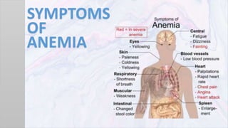 SYMPTOMS
OF
ANEMIA
 