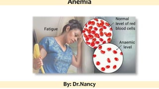 Anemia
By: Dr.Nancy
 