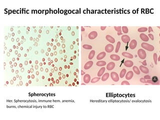 Specific morphologocal characteristics of RBC
Spherocytes
Her. Spherocytosis, immune hem. anemia,
burns, chemical injury to RBC
Elliptocytes
Hereditary elliptocytosis/ ovalocytosis
 