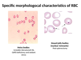 Specific morphologocal characteristics of RBC
Heinz bodies
Unstable (denatured) Hb,
G6PD deficiency and oxidant
stress
Howel-jolly bodies
(nuclear remnants)
Post-splenectomy
 