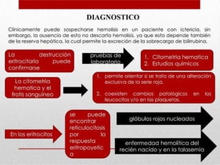 anemia SÑSALLSAPDLSADLASDLSDLASDLASDLASDLS