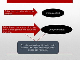 anemia SÑSALLSAPDLSADLASDLSDLASDLASDLASDLS