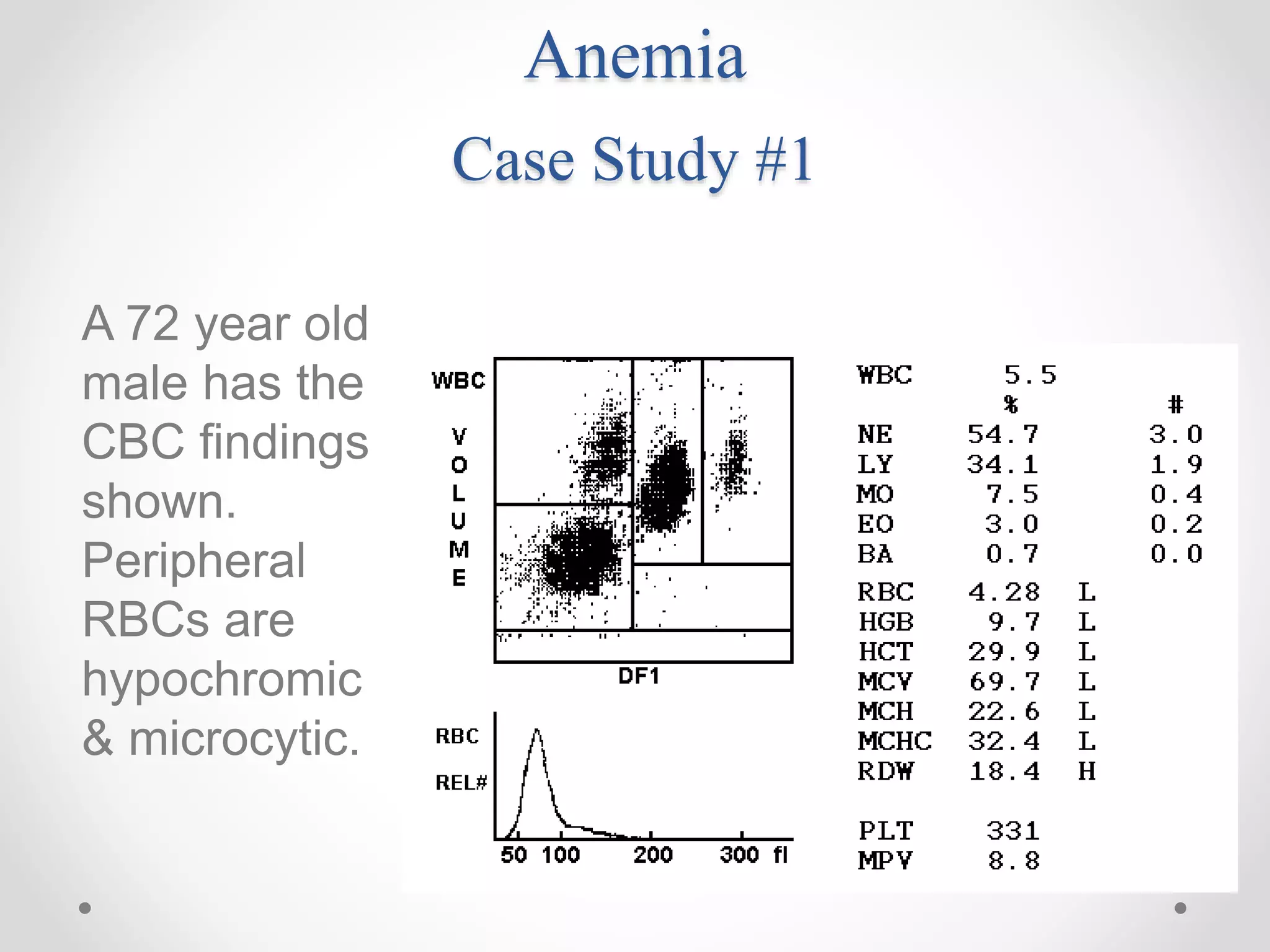 Anemia
Case Study #1
A 72 year old
male has the
CBC findings
shown.
Peripheral
RBCs are
hypochromic
& microcytic.
 
