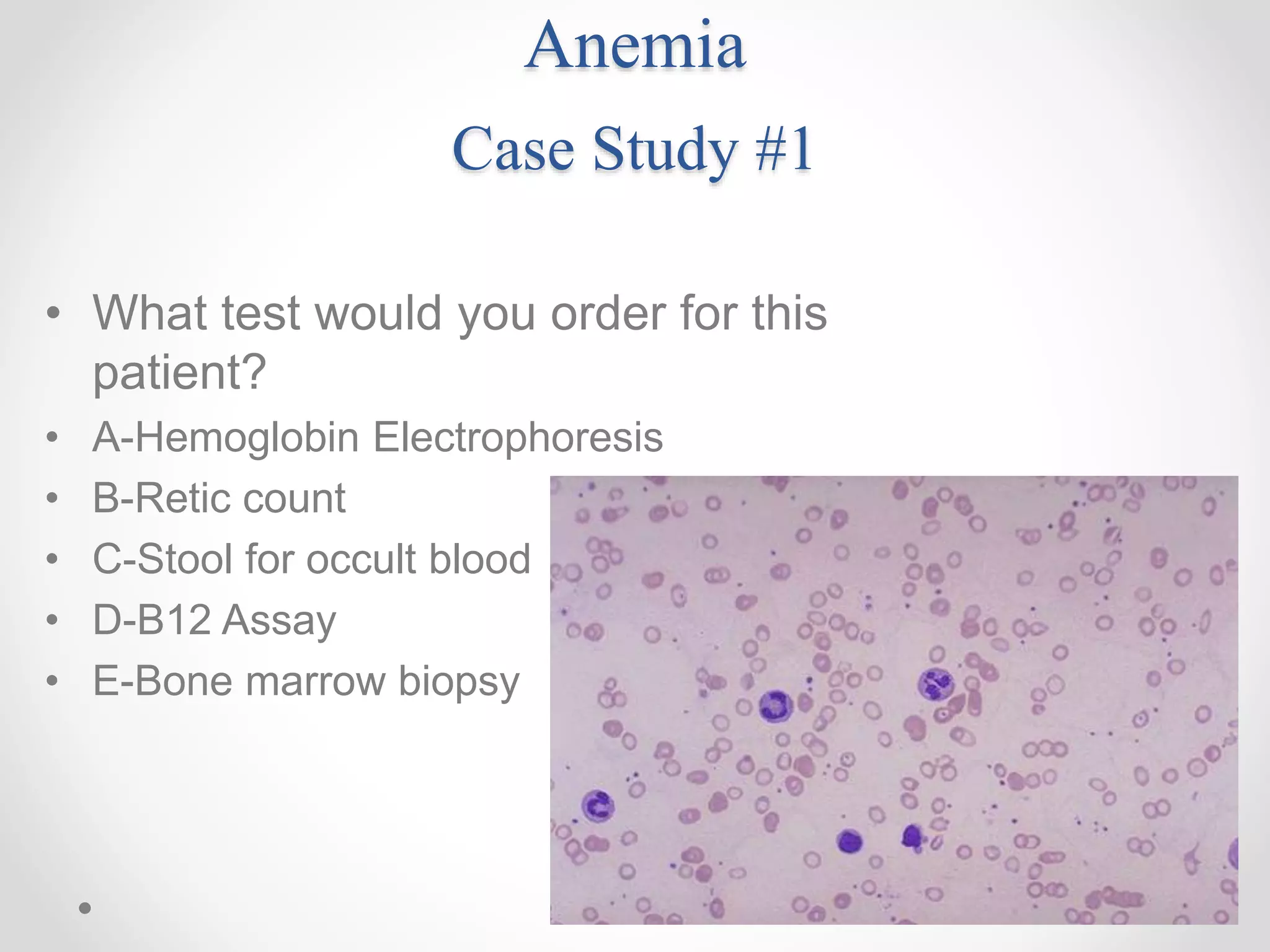 Anemia
Case Study #1
• What test would you order for this
patient?
• A-Hemoglobin Electrophoresis
• B-Retic count
• C-Stool for occult blood
• D-B12 Assay
• E-Bone marrow biopsy
 
