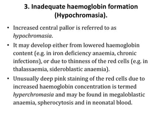 3. Inadequate haemoglobin formation
(Hypochromasia).
• Increased central pallor is referred to as
hypochromasia.
• It may develop either from lowered haemoglobin
content (e.g. in iron deficiency anaemia, chronic
infections), or due to thinness of the red cells (e.g. in
thalassaemia, sideroblastic anaemia).
• Unusually deep pink staining of the red cells due to
increased haemoglobin concentration is termed
hyperchromasia and may be found in megaloblastic
anaemia, spherocytosis and in neonatal blood.
 