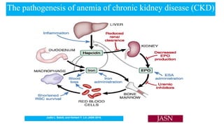 The pathogenesis of anemia of chronic kidney disease (CKD)
Jodie L. Babitt, and Herbert Y. Lin JASN 2016.
 
