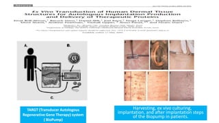TARGT (Transducer Autologous
Regenerative Gene Therapy) system
( BioPump)
Harvesting, ex vivo culturing,
implantation, and after implantation steps
of the Biopump in patients.
 