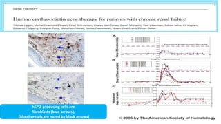 hEPO-producing cells are
fibroblasts (blue arrows),
(blood vessels are noted by black arrows)
 