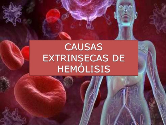 Anemia: definicion, fisiopatología, clasificación desarrollada