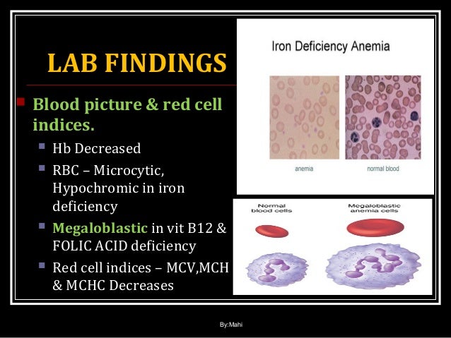 Anemia in physiology