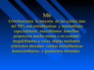 M6M6
Eritroleucemia la mayoria de las celulas masEritroleucemia la mayoria de las celulas mas
del 50% son eritroblasticas y normoblastodel 50% son eritroblasticas y normoblasto
especialmente macroblastos basofilosespecialmente macroblastos basofilos
proporcion mucho menos o en costanteproporcion mucho menos o en costante
megaloblastos a veces atipias nuclearesmegaloblastos a veces atipias nucleares
eritrocitos alterados celulas mieloblasticaseritrocitos alterados celulas mieloblasticas
hemocitoblastos y graulocitos normaleshemocitoblastos y graulocitos normales
 