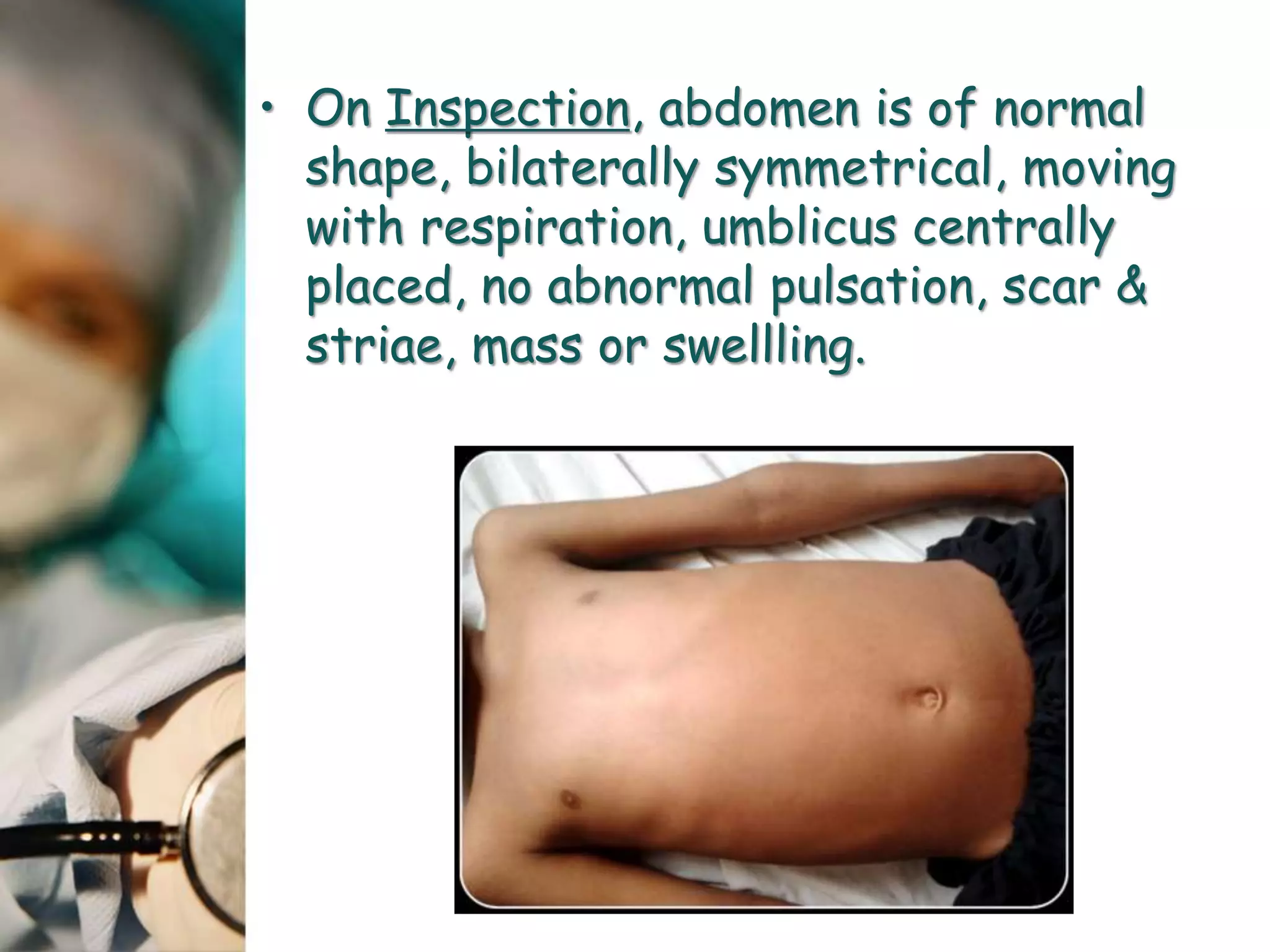 • On Inspection, abdomen is of normal
shape, bilaterally symmetrical, moving
with respiration, umblicus centrally
placed, no abnormal pulsation, scar &
striae, mass or swellling.
 