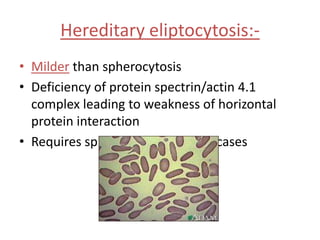 Anemia Presentation | PPTX