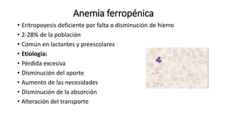 Anemia ferropénica
• Eritropoyesis deficiente por falta o disminución de hierro
• 2-28% de la población
• Común en lactantes y preescolares
• Etiología:
• Pérdida excesiva
• Disminución del aporte
• Aumento de las necesidades
• Disminución de la absorción
• Alteración del transporte
 