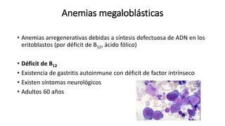 Anemias megaloblásticas
• Anemias arregenerativas debidas a síntesis defectuosa de ADN en los
eritoblastos (por déficit de B12, ácido fólico)
• Déficit de B12
• Existencia de gastritis autoinmune con déficit de factor intrínseco
• Existen síntomas neurológicos
• Adultos 60 años
 