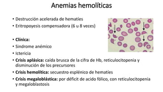 Anemias hemolíticas
• Destrucción acelerada de hematíes
• Eritropoyesis compensadora (6 u 8 veces)
• Clínica:
• Sindrome anémico
• Ictericia
• Crisis aplásica: caída brusca de la cifra de Hb, reticulocitopenia y
disminución de los precursores
• Crisis hemolítica: secuestro esplénico de hematíes
• Crisis megaloblástica: por déficit de acido fólico, con reticulocitopenia
y megaloblastosis
 