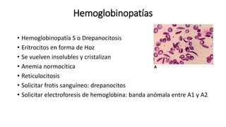 Hemoglobinopatías
• Hemoglobinopatía S o Drepanocitosis
• Eritrocitos en forma de Hoz
• Se vuelven insolubles y cristalizan
• Anemia normocítica
• Reticulocitosis
• Solicitar frotis sanguíneo: drepanocitos
• Solicitar electroforesis de hemoglobina: banda anómala entre A1 y A2
 