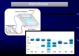 Eletroforese
 