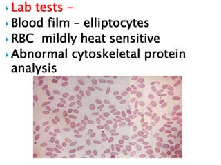  Lab tests –
 Blood film – elliptocytes
 RBC mildly heat sensitive
 Abnormal cytoskeletal protein
analysis
 