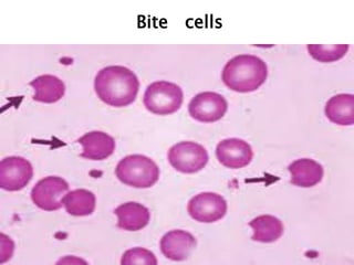 Bite cells
 
