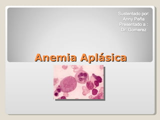 Anemia Aplásica 