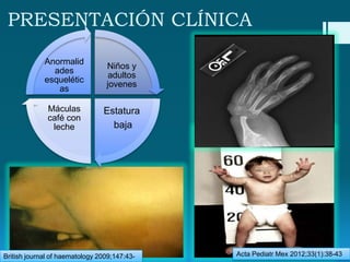 PRESENTACIÓN CLÍNICA
Anormalid
ades
esquelétic
as

Niños y
adultos
jovenes

Máculas
café con
leche

Estatura
baja

British journal of haematology 2009;147:43-

Acta Pediatr Mex 2012;33(1):38-43

 
