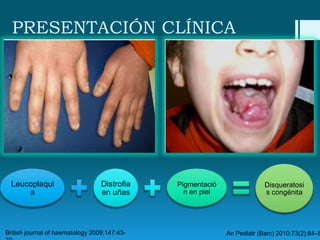 PRESENTACIÓN CLÍNICA

Leucoplaqui
a

Distrofia
en uñas

British journal of haematology 2009;147:43-

Pigmentació
n en piel

Disqueratosi
s congénita

An Pediatr (Barc) 2010;73(2):84–8

 